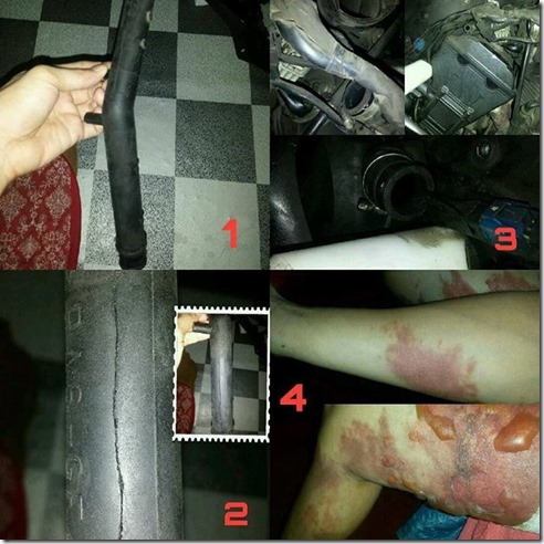 akibat selang radiator pecah