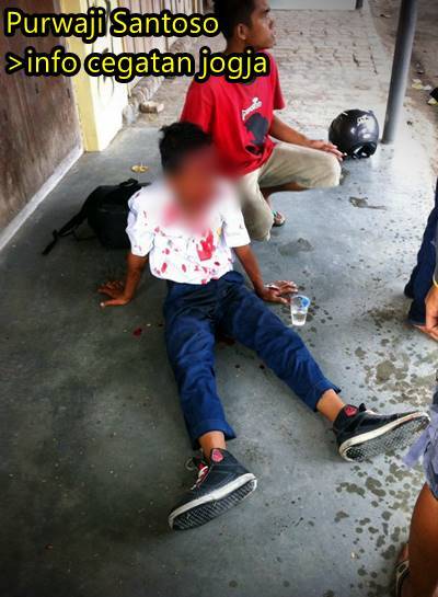 anak SMP kecelakaan di imogiri hampir dilindas truk 0