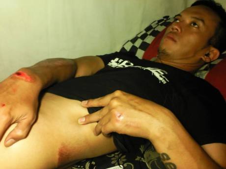 Pengendara motor jadi korban konvoi harley davidson 1