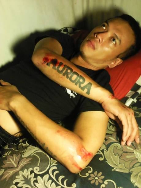 Pengendara motor jadi korban konvoi harley davidson 2