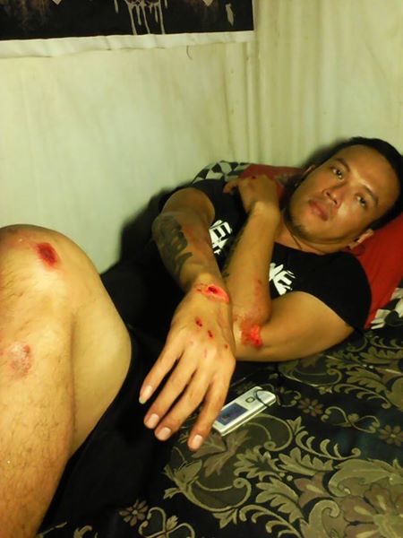 Pengendara motor jadi korban konvoi harley davidson 3