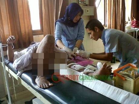 kecelakaan di jogja satu tulang satu lupa ingatan patah y