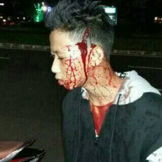 korban begal ciputat