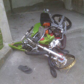 Kala Ninja Ban Cacing Gagal Nikung Tabrak Pagar Masuk Got Di Jogja, Wow Ban Masih Utuh 1