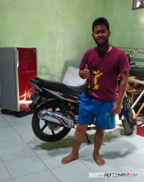 kondisi-pertamax7.com-usai-sakit-kram-otot-1